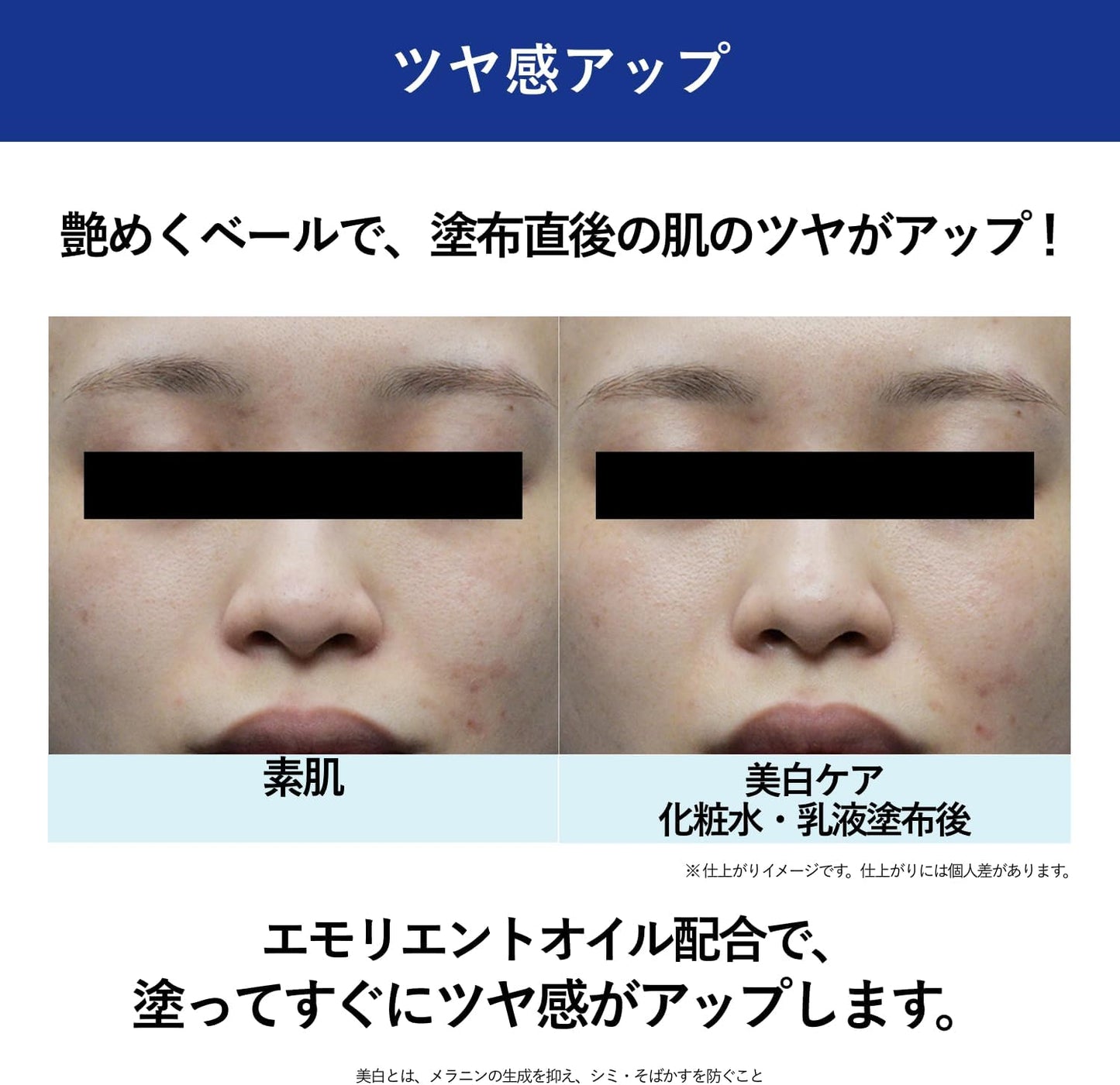 Aqua Label Treatment Lotion (Brightening), Moist 6.1 fl oz (170 ml), Main Body, CICA 4MSK Cosmetic Water, Whitening Care, [Quasi-drug], Released February 2024